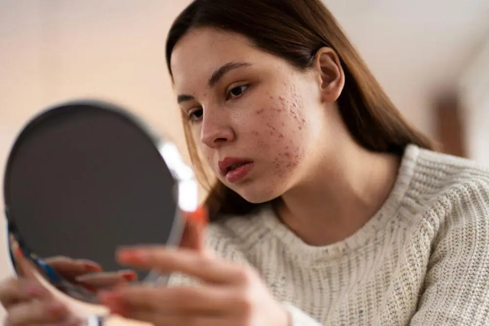 person-dealing-with-rosacea-23-2150478728-ca1834d54993c733222d325499cbe090-5cc583842eda9c74aacc72009c8fa028